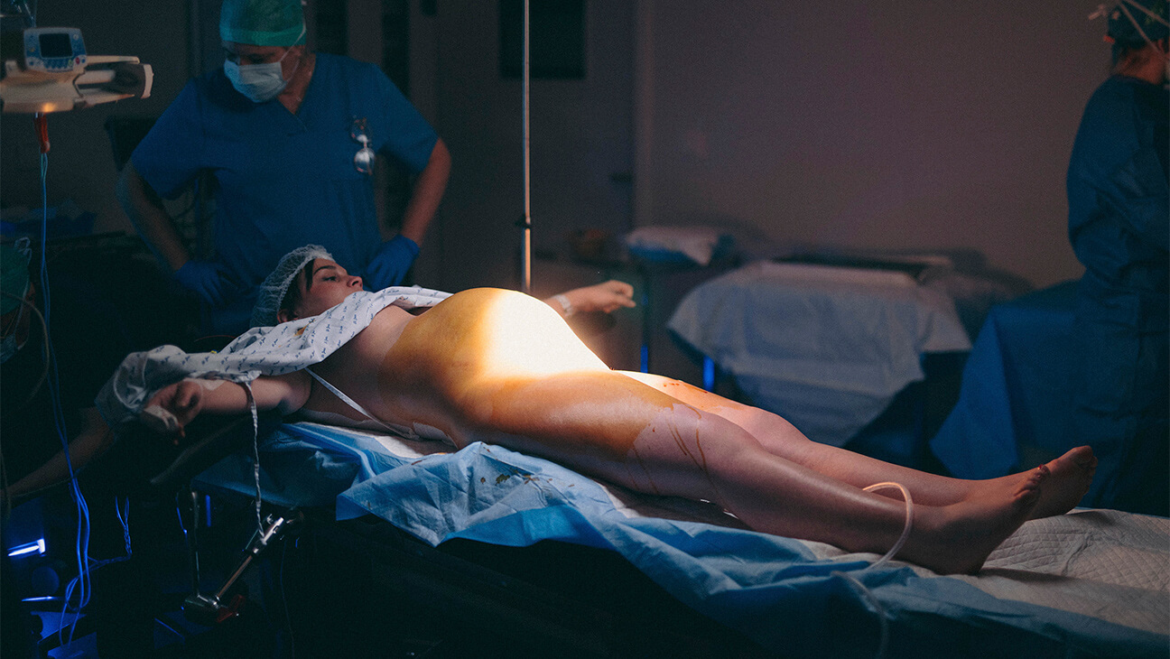 Vrouw in ontbloot onderlichaam op een operatietafel